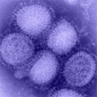Вирус свиного гриппа под микроскопом