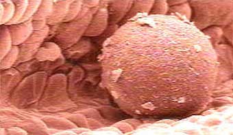Имплантация эмбриона под микроскопом