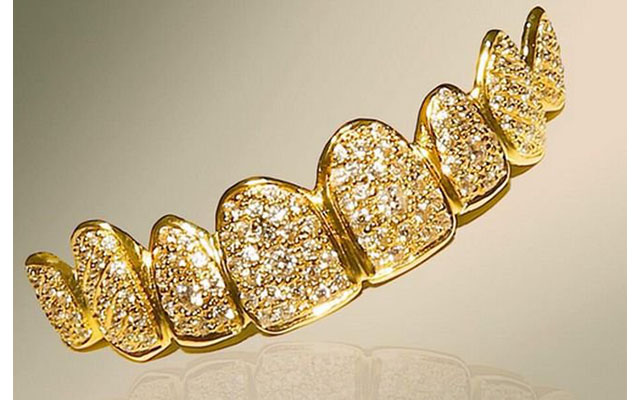 Стоматологи в Дубае создали самую дорогую улыбку в мире