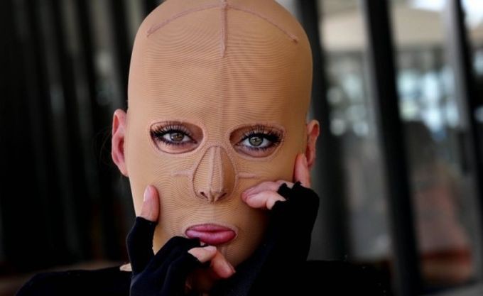 Жизнь без лица закончена: австралийка сняла маску, которую носила 2,5 года