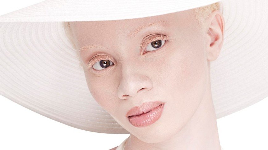 Альбиносы в мире моды