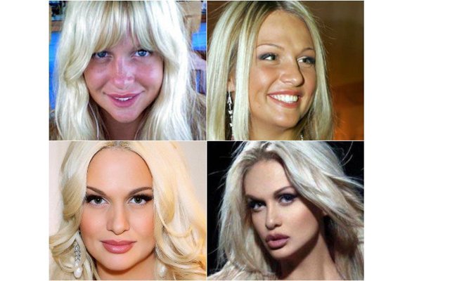 Кто из российских знаменитостей сделал пластику носа?