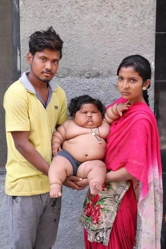 8-месячная малышка из Индии весит 17 килограммов