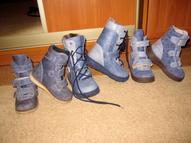 Обувь при вальгусной деформации стопы