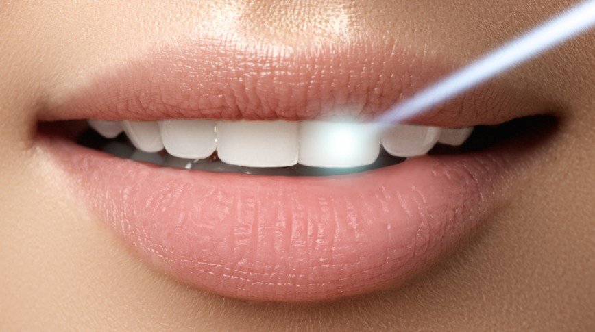 Лазер или бормашина: как продвинутые пациенты лечат зубы