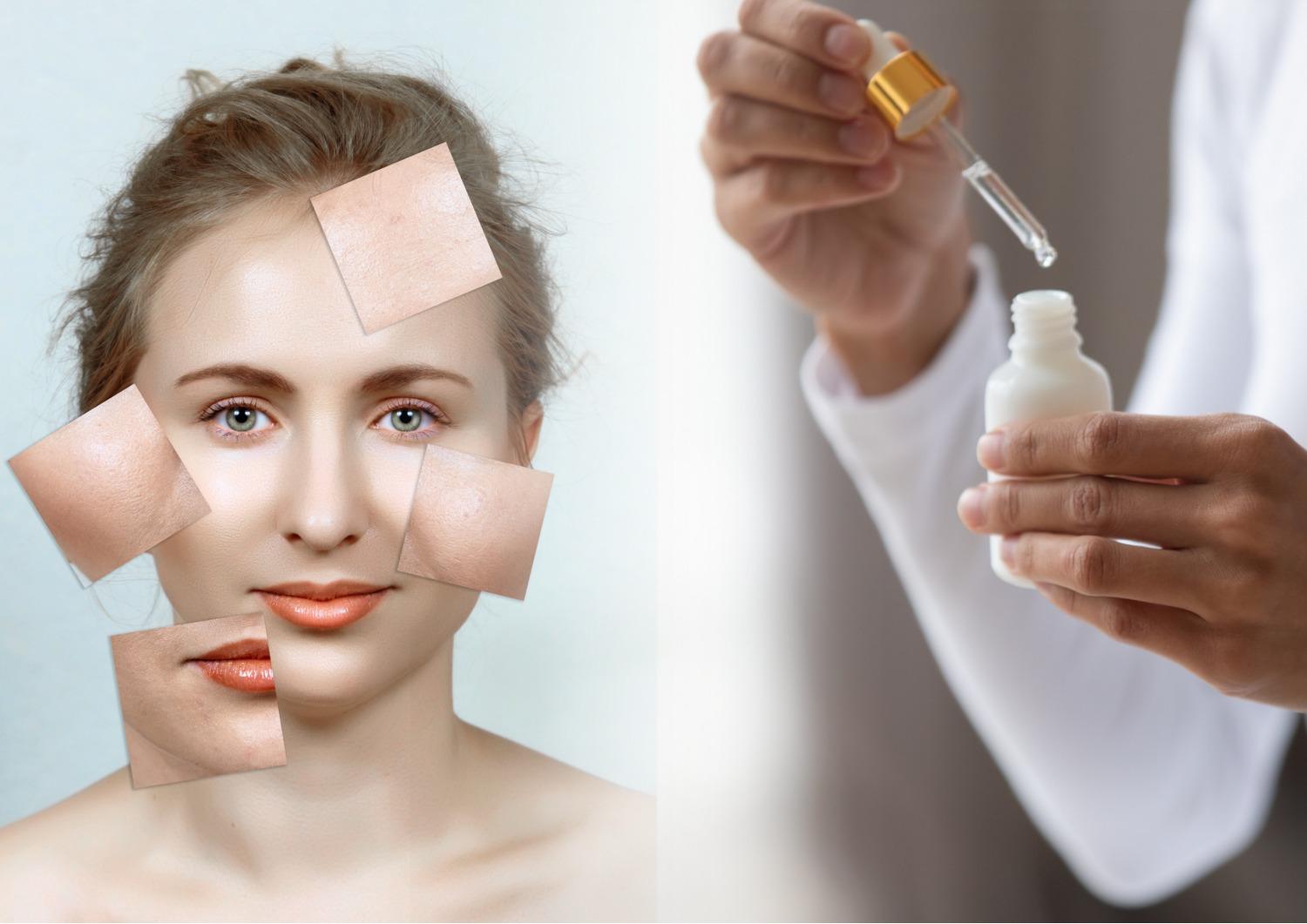 Ретинол всемогущий: гид от косметолога по самому противоречивому веществу, способному полностью изменить вашу кожу