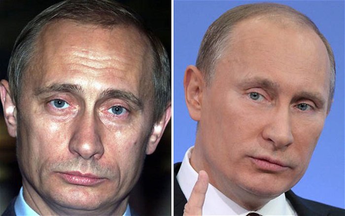 Путин и ботокс