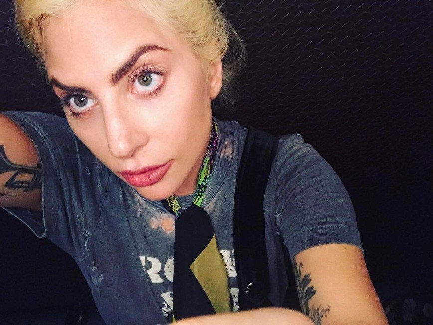  Леди Гага попала в больницу из-за сильных болей в бедре