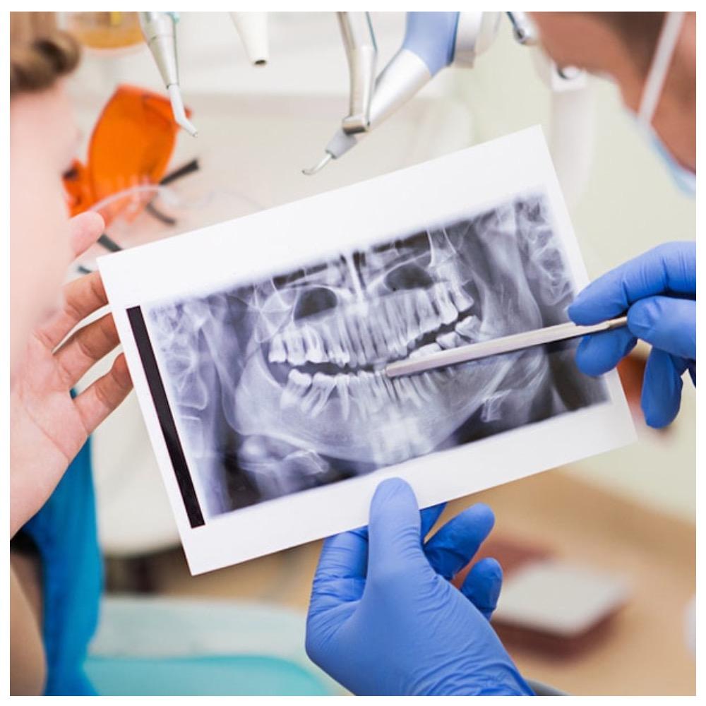 Инсульт, импотенция и другие болезни, которые появятся, если игнорировать стоматолога