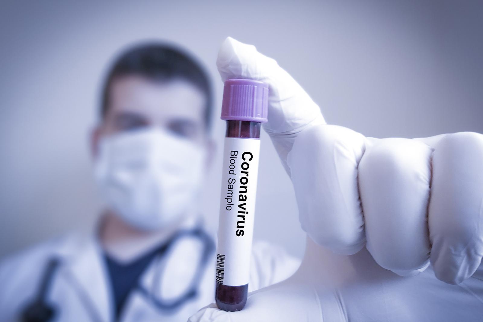 В России начали тестировать вакцину от коронавируса