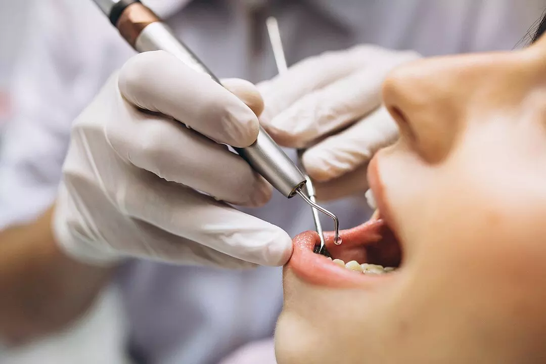 На приеме у стоматолога нужно обязательно рассказать о диагнозе, о том, как давно он был поставлен, какие препараты назначил эндокринолог и в какой дозировке