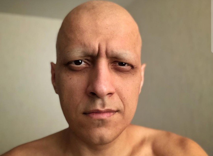 Болеющий раком Эдуард Мацаберидзе призывает регулярно обследоваться