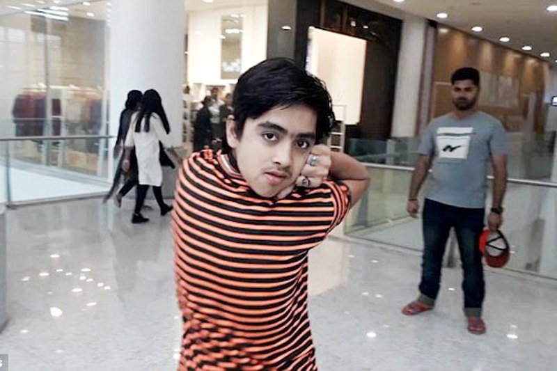 «У него шея резиновая?»: подросток из Пакистана научился поворачивать голову на 180 градусов