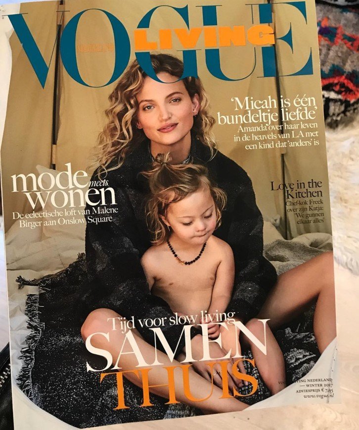 Ребенок с синдромом Дауна появился на обложке Vogue