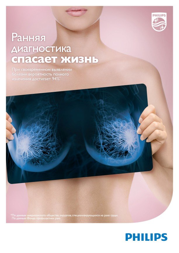  Россиянки смогут бесплатно пройти маммографию